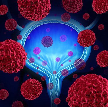 Современные вопросы молекулярной диагностики рака мочевого пузыря